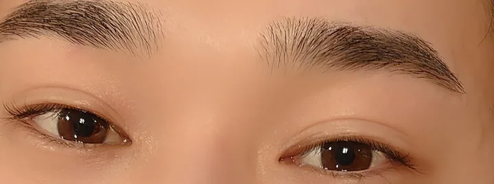 施術後の眉