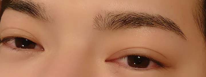 施術後の眉