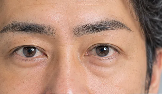 眉毛パーマの後(形や濃さにムラがある眉・目元)