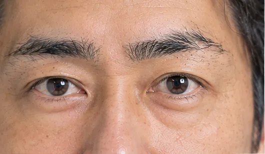 眉毛パーマの前(形や濃さにムラがある眉・目元)