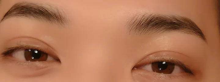施術後の眉