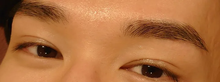 施術後の眉