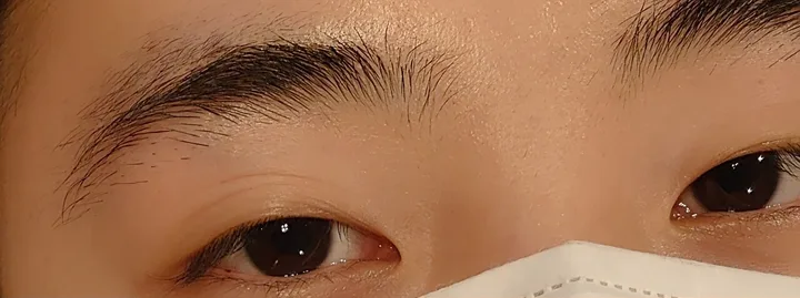 施術前の眉(上下に毛が多い眉)