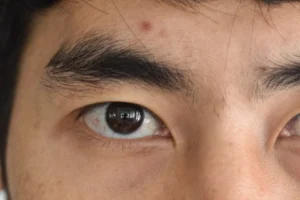 つながり眉の眉間、どこまで処理すればいい？