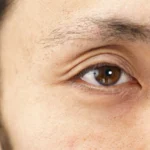 眉毛が生えてこないのはなぜ？原因と対処法