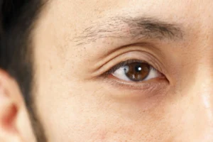 眉毛が生えてこないのはなぜ?原因と対処法
