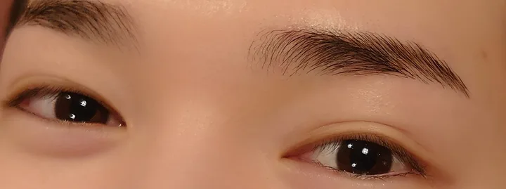 施術後の眉
