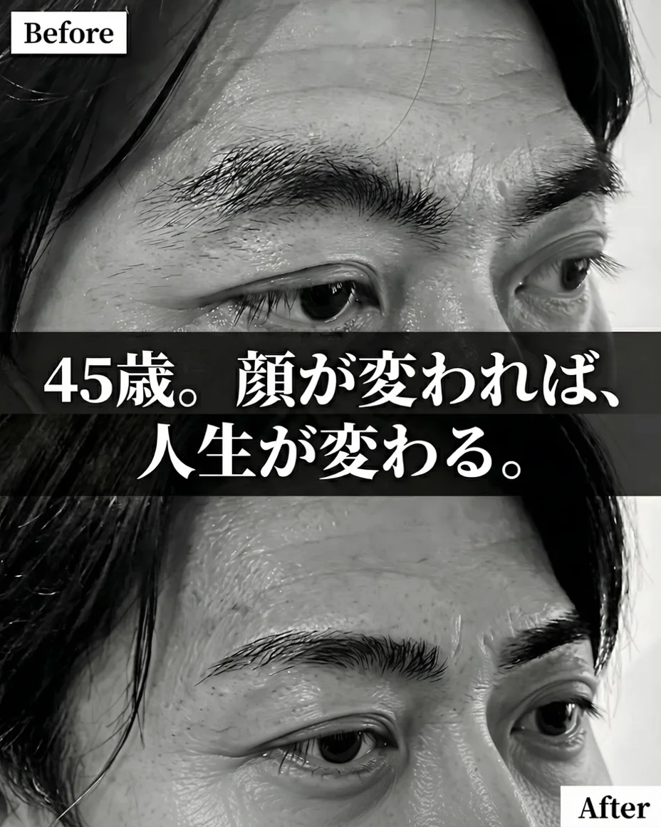 オーナー浅野武富 45歳当時の眉毛Before/After